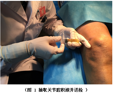 臭氧关节腔注射治疗膝关节炎,如图1,图2